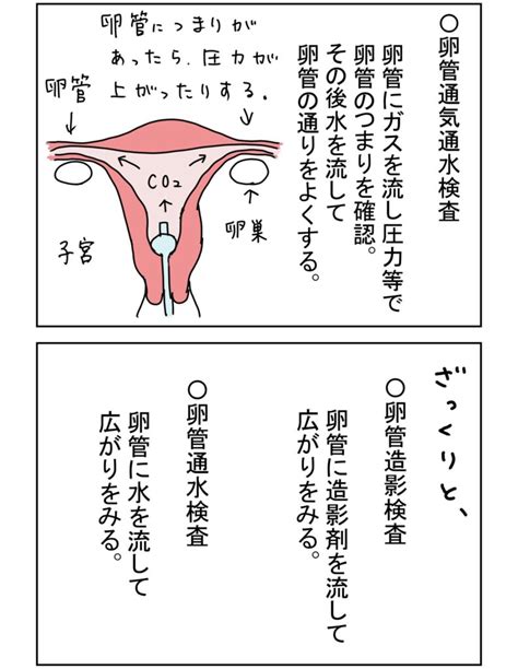 卵管通気通水検査① アラフォー主婦の不妊治療な日々