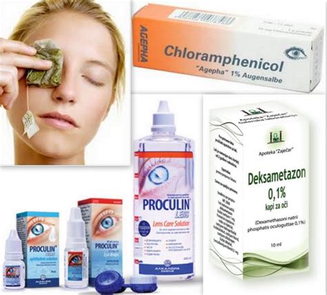 KONJUKTIVITIS - Šta je i kako ga izlečiti | Mala Medicina Za Poneti