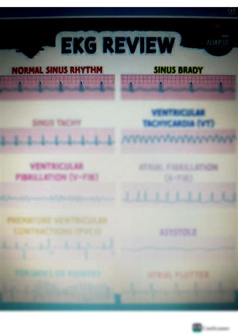 Solution Ekg Review Studypool