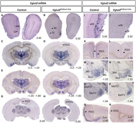 Full Article Targeted Deletion Of Vglut2 Expression In The Embryonal