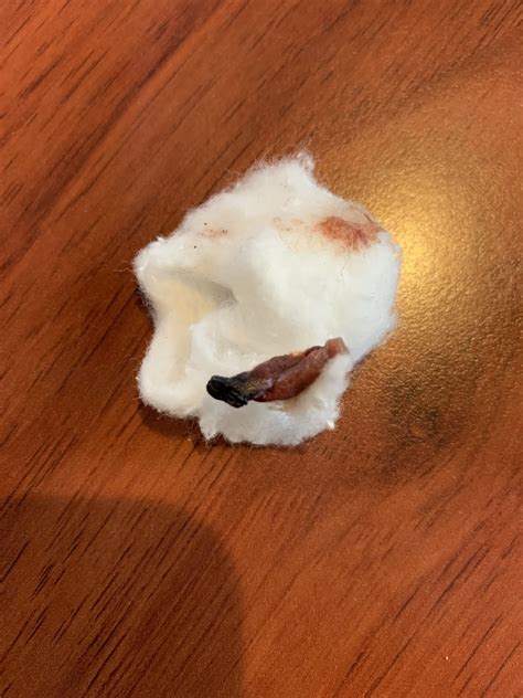 This came out of my ear ~ 3 weeks after surgery? : r/popping