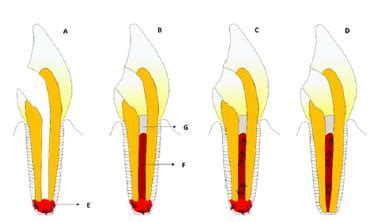 Scielo Brasil What Is The Clinical Applicability Of Regenerative