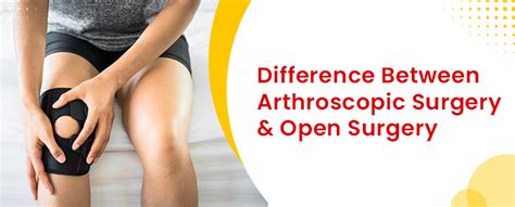 Difference Between Arthroscopic Surgery And Open Surgery Germanten