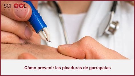 C Mo Prevenir Las Picaduras De Garrapatas School Nurses