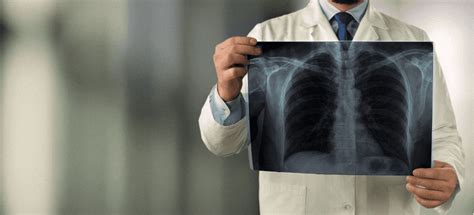 understanding  vital role  radiologists