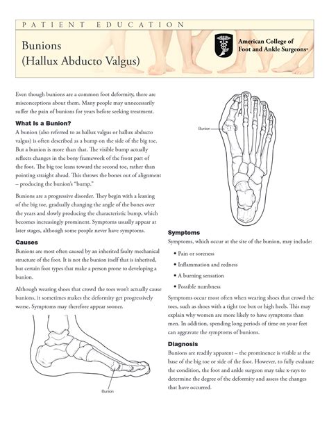 Bunion Treatment in Portland & Sandy, OR | Bunion Centers of Oregon