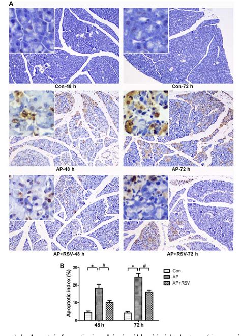 Figure From Resveratrol Protects Against L Arginine Induced Acute