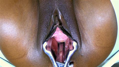 EdgingBabe Mathieu Speculum Babe Pussy ManyVids