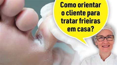 Como Acabar Com A Frieira Em 3 Dias - CLIENTE COM FRIEIRA: COMO ORIENTAR PARA TRATAR EM CASA? - YouTube