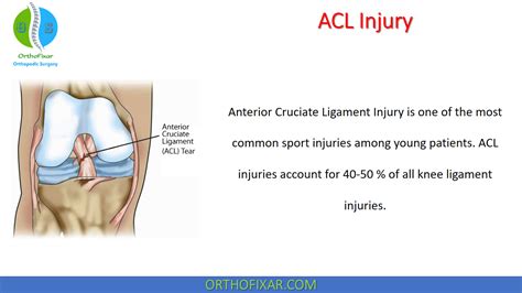 Anterior Cruciate Ligament Acl Injuries What Are They Female Acl