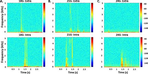 Spectrogram Of The Vibration Signal Illustrated Frequency Kilohertz Or Download Scientific