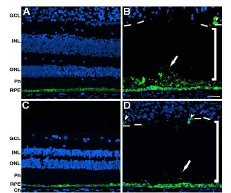 presence  rpe cells  cells expressing rpe   retina