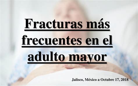 Fracturas M S Frecuentes En El Adulto Mayor By Jessica Ba Uelos Flipsnack