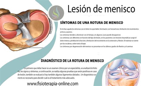 Conoces Los Tipos De Lesiones De Menisco Por Qu Se Producen Blog The