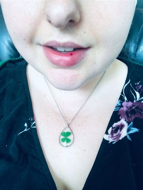 A Continuation of Learning (Head-butted by my idiot of a dog. I knew it