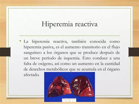Hiperemia O Que é 6