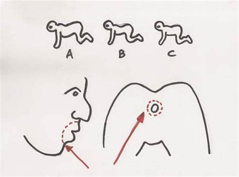 Is The Human Centipede Really Medically Possible Doctors Weigh In