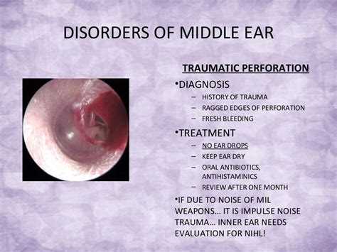 Common Ent Problems And Managements