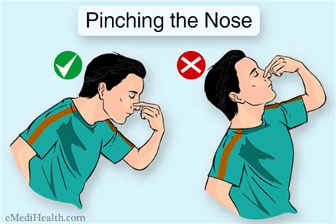 How To Help A Nosebleed - Gameclass18