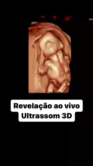 Descobrindo o sexo do bebê