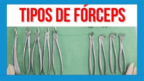 Conociendo Los Tipos De Forceps Dentales Nombres Y Usos Blog Dental