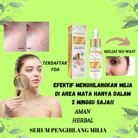 Jual Milia Cream Krim Penghilang Milia Jerawat Bintik Putih Di Bawah Mata Shopee Indonesia