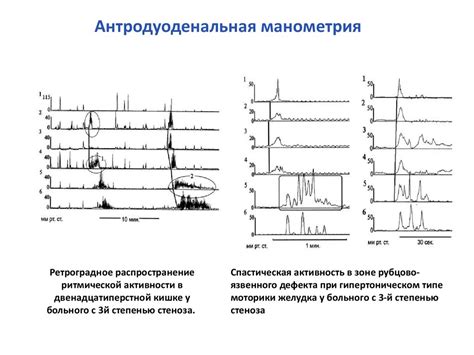 Функциональная гастроэнтерология - презентация онлайн