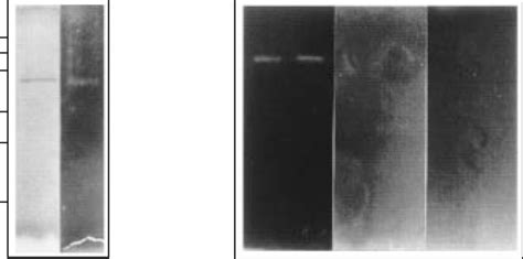 Proteolytic Activity In Ecps Of P Infestans A Sds Page Analysis Of