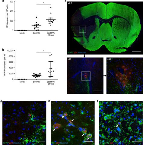 Ischemic Stroke Results In Increased Cns Viral Load Mice Were Infected