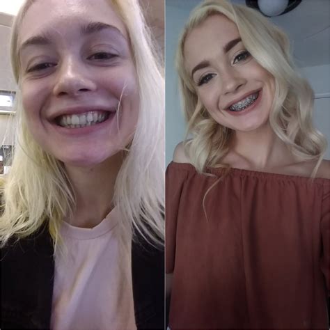 Anastasia Knight Anyone Looking Forward To Some Brace Face Teen Themed Porn From Her