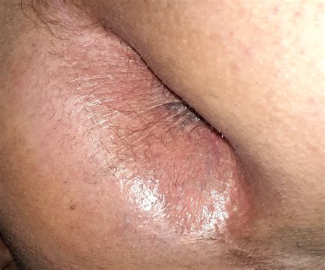 My Ass Ready For Cock Pics Xhamster