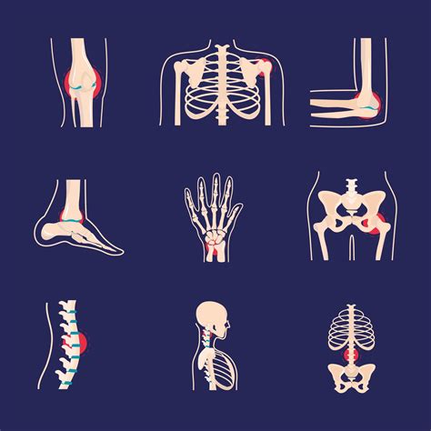 rheumatology disorder set 2503347 Vector Art at Vecteezy