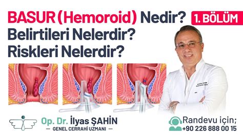 BASUR HEMOROİD NEDİR BASUR HEMOROİD BELİRTİLERİ NELERDİR YouTube