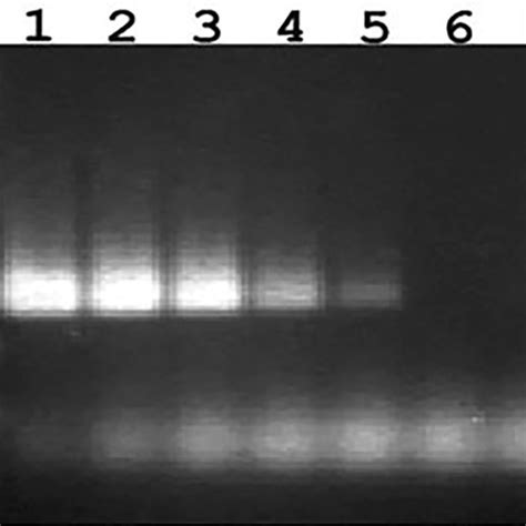 Sensitivity Of Conventional Pcr Assay Using Ab35326 Primers And