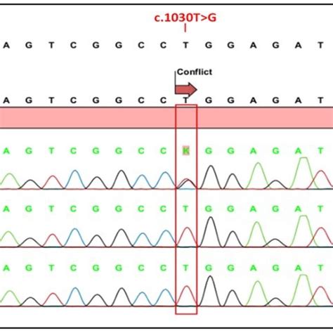 Electropherograms Of Sanger Sequencing Of Peripheral Blood Lymphocyte