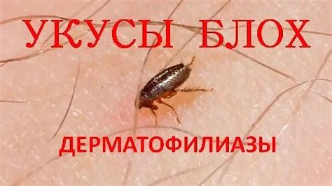 Как выглядит укус земляных блох? Ответов на вопрос: 24