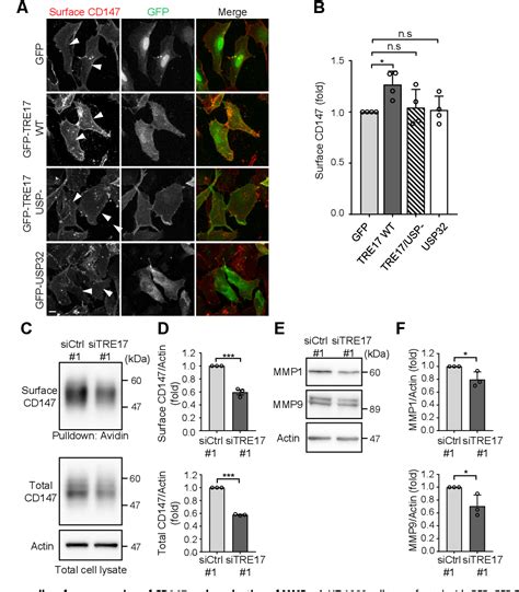 Figure 1 From Ubiquitin Specific Protease TRE17 USP6 Promotes Tumor