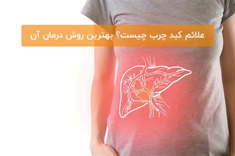 علائم کبد چرب چیست؟ بهترین روش درمان آن رژیم غذایی خبرگزاری آنا