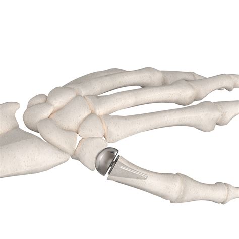 cruth trapezoide