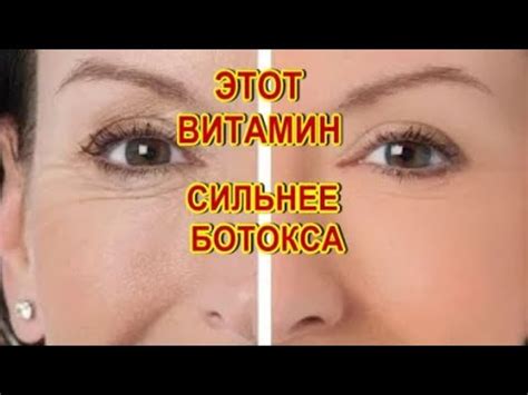 Этот Витамин Сильнее Ботокса!Уколы Красоты! Домашний Ботокс за копейки ...