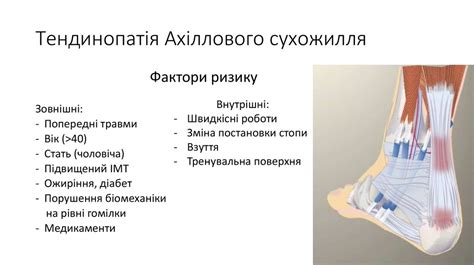 Спортивні травми - презентация онлайн