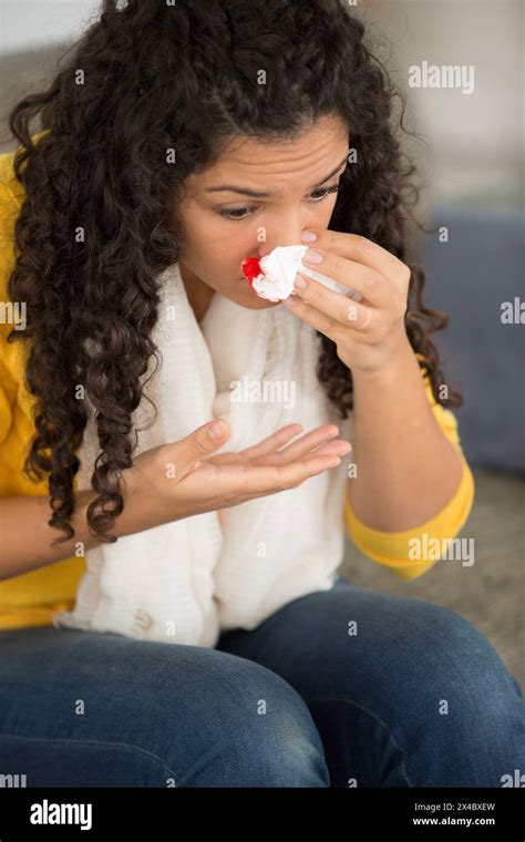 Bloody Nose Hi Res Stock Photography And Images Alamy