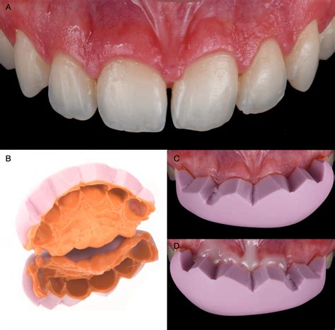 dental  medical problems