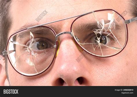 Goofy Man Broken Image And Photo Free Trial Bigstock