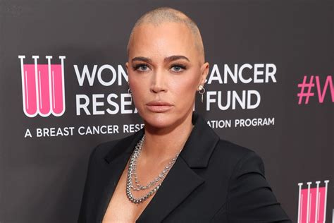 Teddi Mellencamp recalls crying when she first saw her cancer scars