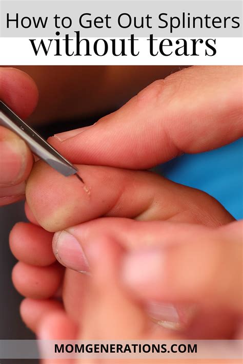 How To Get Out A Splinter From Under Your Nail Howtoermov