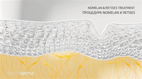 Пилинги Medi+derma - YouTube