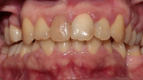 Естетска стоматологија | Dentizar