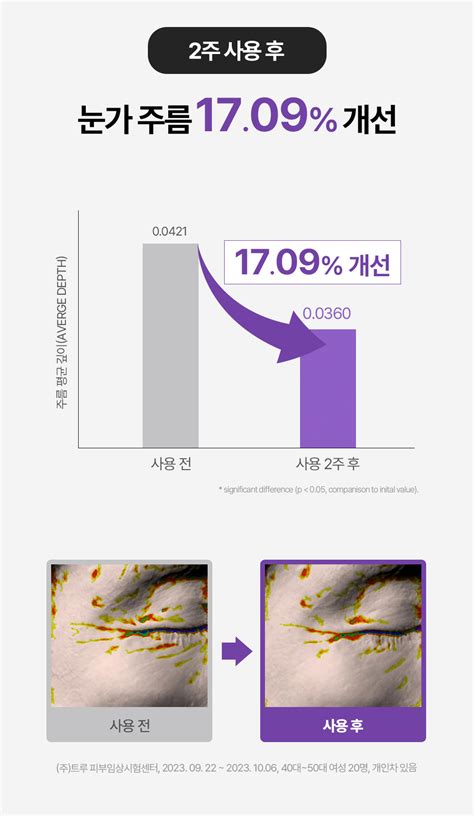 주름개선기능성 콜라겐 팔자미간 주름패치 1박스 12패치x5매입 총 60패치 감도 깊은 취향 셀렉트샵 29cm