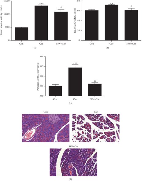 Figure 1 From Sulforaphane Protects Pancreatic Acinar Cell Injury By